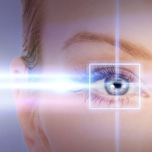 Cirurgia Laser nos olhos em Araçatuba